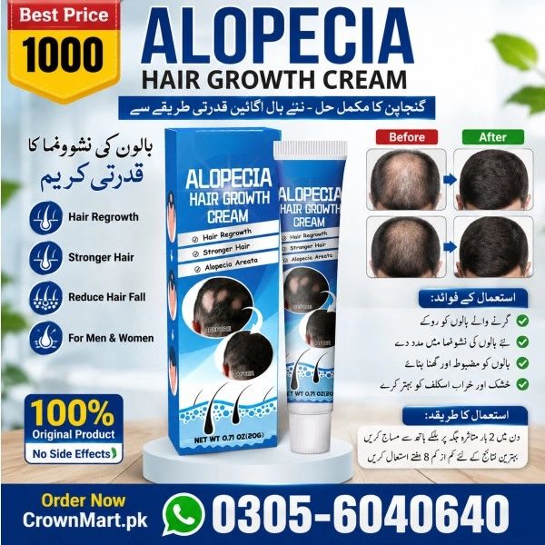 Alopecia Hair Growth Cream Price in Pakistan
