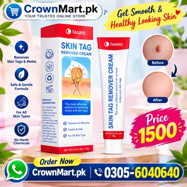 Skin Tags Removal Cream In Pakistan