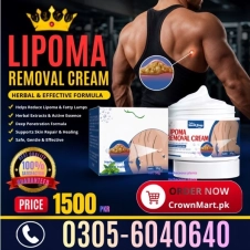 Lipoma Removal Cream in Pakistan